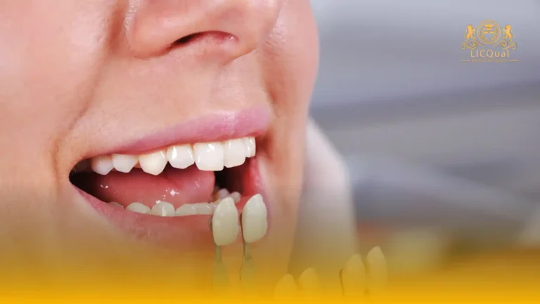 LICQual Level 3 Certificate in Aesthetic Dentistry 