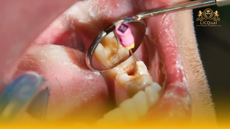 LICQual Level 3 Certificate in Endodontics