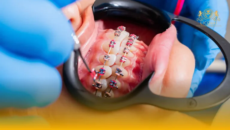 LICQual Level 3 Certificate in Orthodontics