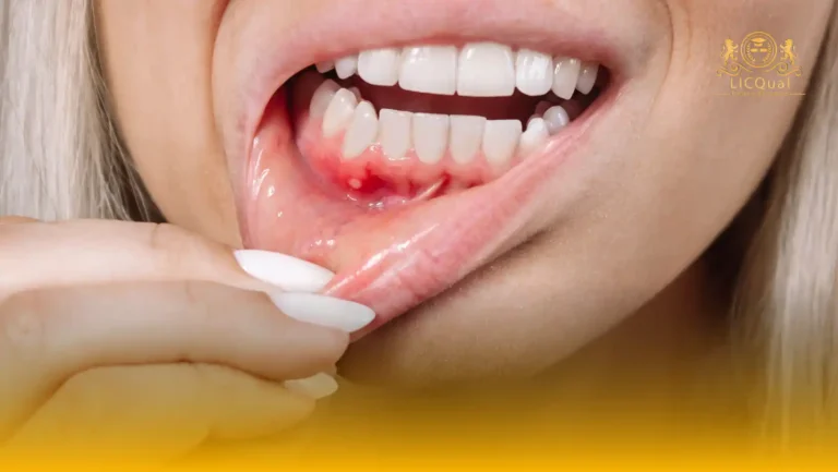 LICQual Level 3 Certificate in Periodontics