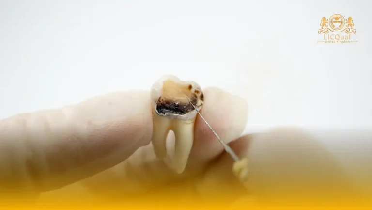 LICQual Level 3 Diploma in Endodontics