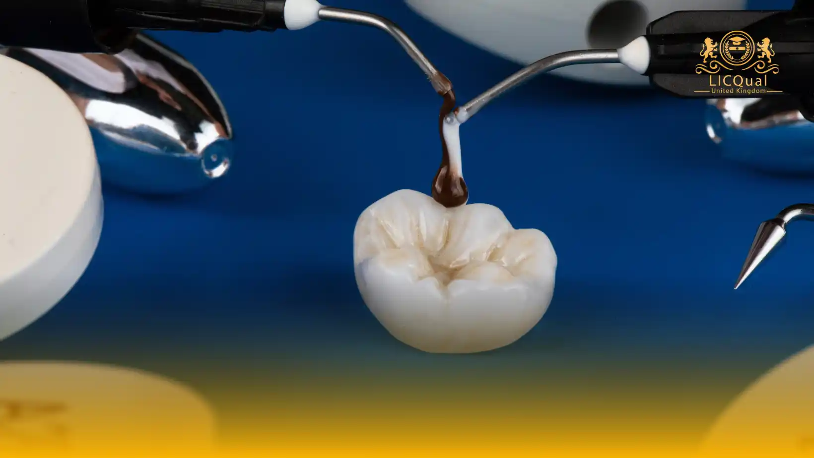 LICQual Level 6 Diploma in Dental Materials (Dip Dental Materials)