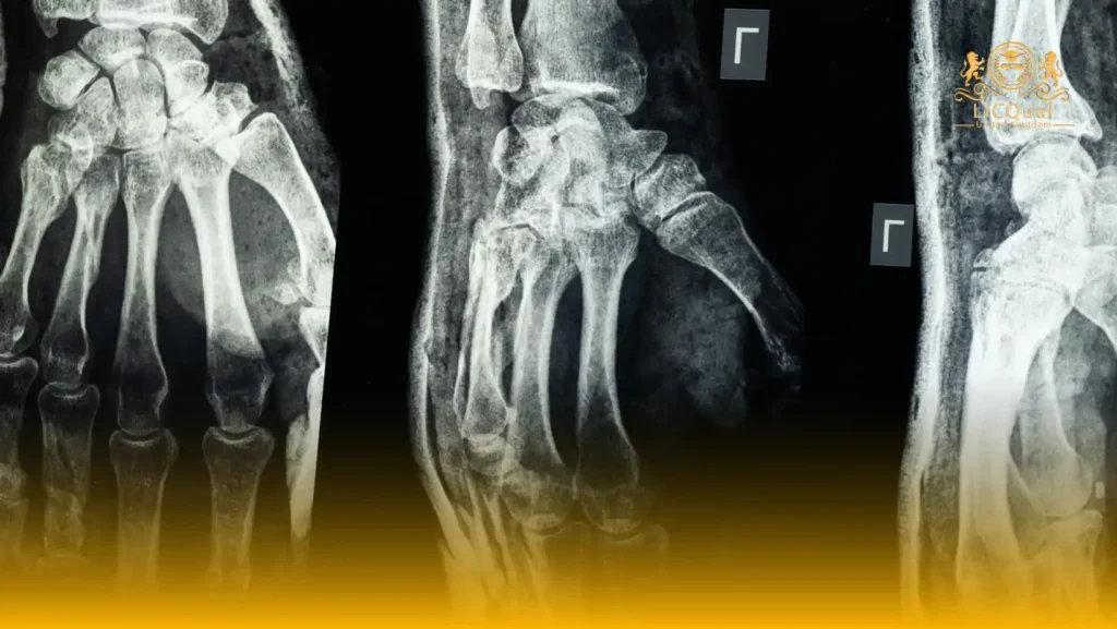 LICQual Level 7 Postgraduate Diploma in Radiology (PgDRD)